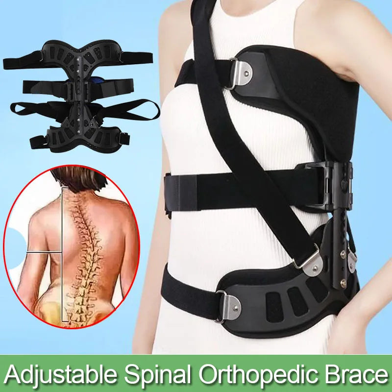 Scoliosis Brace Posture Corrector – Adjustable Spinal Orthosis for Postoperative Back Recovery (Left/Right Side)