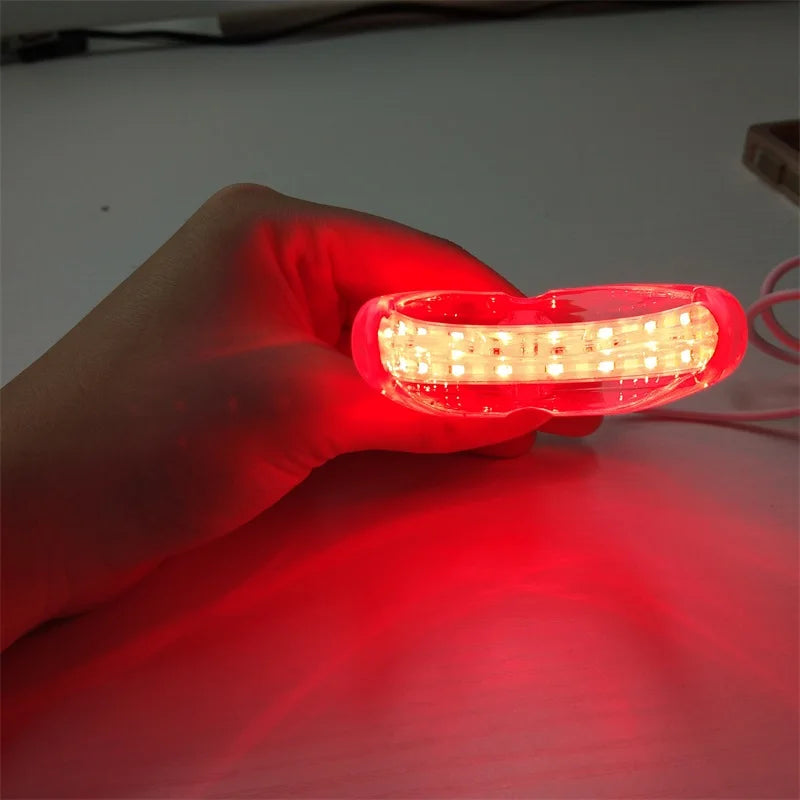 Red Light Therapy Device – Immediate Relief for Tooth Pain & Gum Sensitivity - Image 5